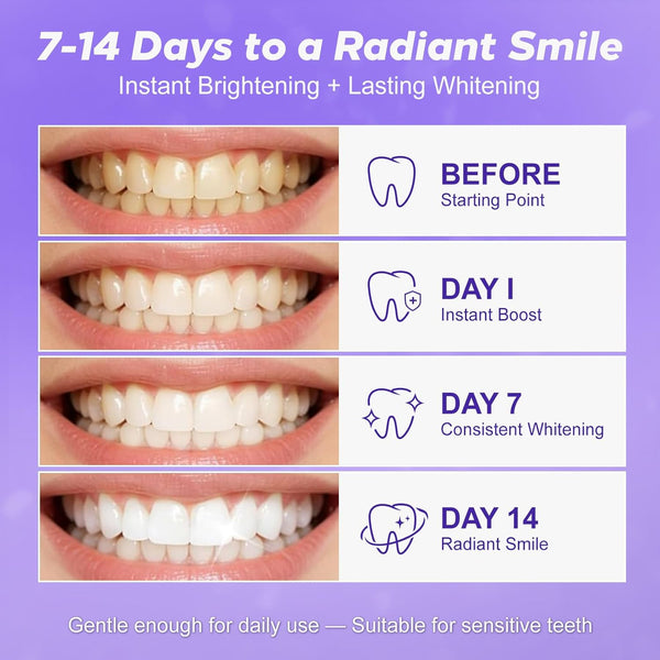 Sparkling Smile Whitening Strips
