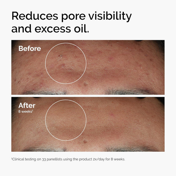 Smooth Radiance Face Serum